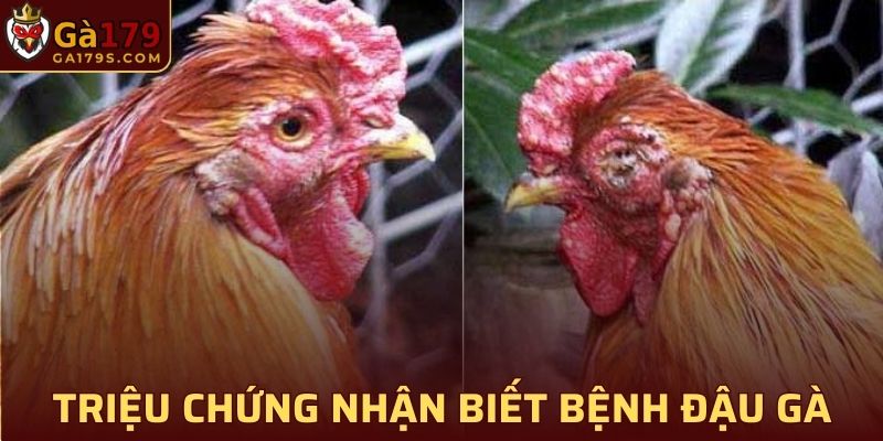 Những triệu chứng dễ nhận biết của bệnh đậu gà